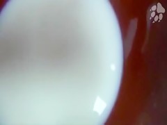Thumb 20